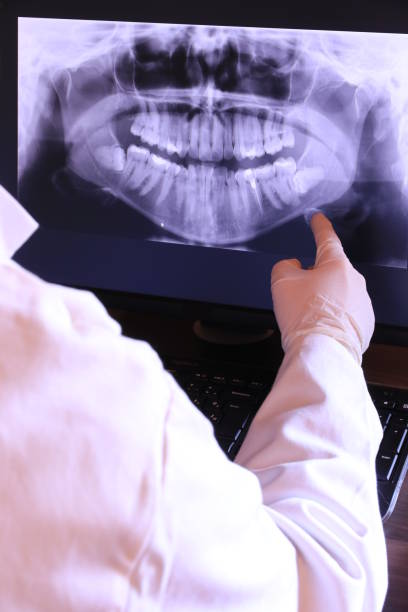 Best Emergency Tooth Extraction in St Augustine, FL
