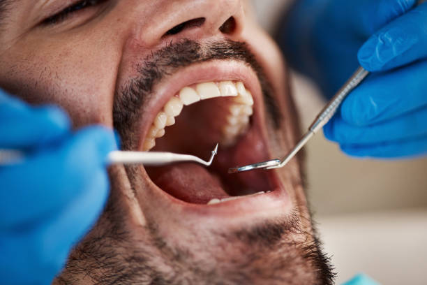Best Cosmetic Emergency Dentistry in St Augustine, FL
